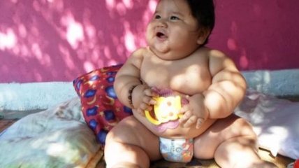 10-месячная девочка весит как пятилетний ребенок
