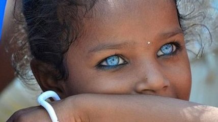 Уникальные темнокожие дети с бриллиантовыми глазами (Фото)