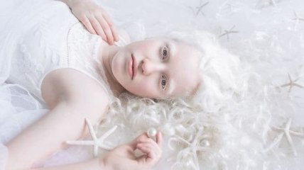 Завораживающие снимки людей-альбиносов, от которых не оторвать взгляд (Фото)