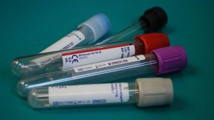 На Рівненщині підтвердили 18 нових випадків коронавірусу