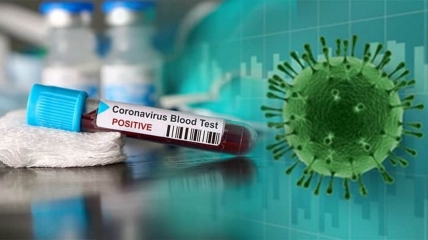 Позитивный тест на коронавирус
