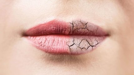 Користуйтеся цим методом - і ваші губи більше ніколи не потріскаються