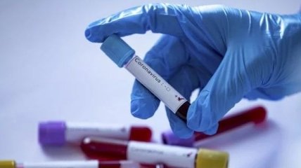 На Херсонщині з підозрою на коронавірус госпіталізували дитину