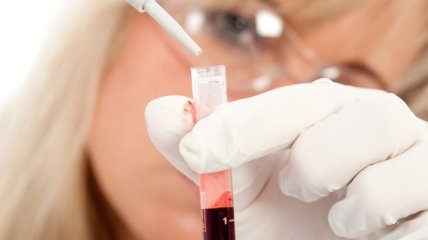 Обнаружен новый вирус, который передается через кровь 