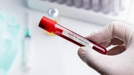 Эпидемия коронавируса: в Винницкой области зарегистрировано 766 инфицированных