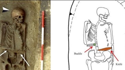 Археологи обнаружили скелет мужчины, прожившего жизнь с ножом вместо руки