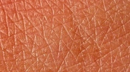 10 проблем, о которых вам расскажет ваша кожа