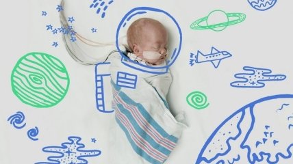 Из отделения интенсивной терапии на Луну: трогательные младенцы (ФОТО)
