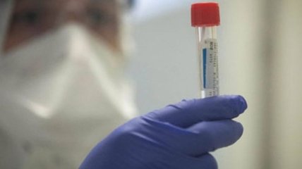 На Вінниччині п'ятеро хворих на коронавірус перебувають у тяжкому стані