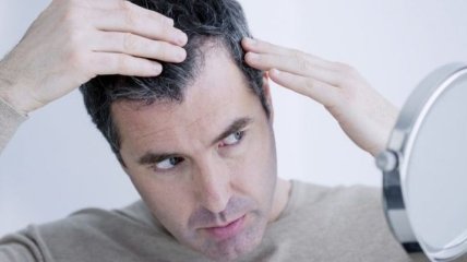 Біологи відкрили новий метод відновлення волосся у чоловіків