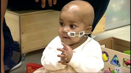 Годовалую девочку вылечили от рака с помощью генотерапии