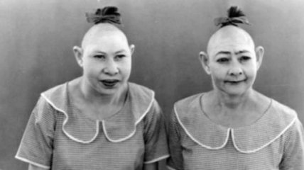 Пип и Флип: дуэт сестер с "булавочными головками" из цирка уродцев (Фото) 