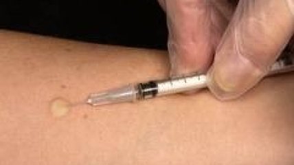 В Украине приостановлены пробы Манту