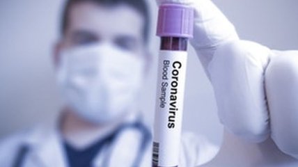 У Білорусі та ще в двох країнах зареєстрували перші випадки коронавірусу