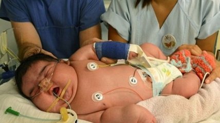 В Германии родился мальчик весом 6,1 кг (Фото) 