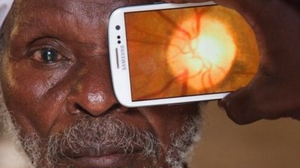 Проверить зрение можно при помощи смартфона