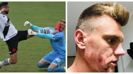 Шипами в лицо: в Бразилии футболист перепутал голову вратаря с мячом (видео)