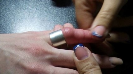 В Днепре сотрудники ГСЧС помогли женщине снять кольцо с пальца