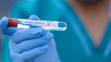 На Житомирщине за сутки зафиксировали 18 случаев коронавируса
