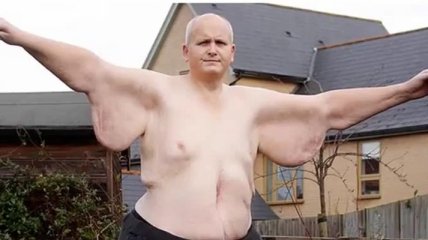 Бывший "самый толстый человек в мире" Пол Мэйсон нашел свою любовь  