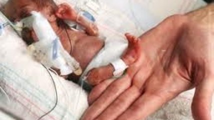Донецкие медики спасли малышку весом полкилограмма