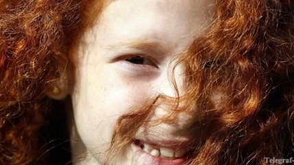 Рыжие волосы помогают бороться с нехваткой солнца