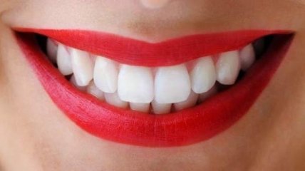 Медики предупредили об опасности отбеливания зубов