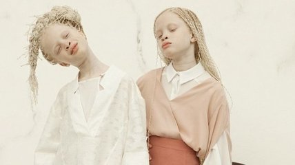 Очаровательные близняшки-альбиносы покорили интернет своей красотой (Фото)
