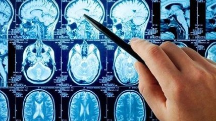 Компьютерные игры снижают риск развития болезни Альцгеймера