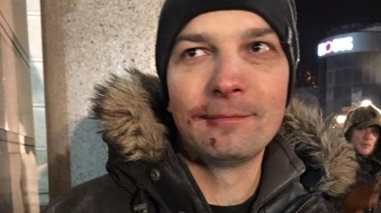 Во время столкновений в центре Киева избили депутата