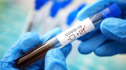 У Нідерландах виявили 31,5 тисяч випадків коронавірусу