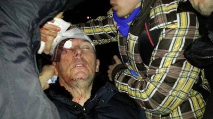 МВД: Момента избиения Луценко на видео нет