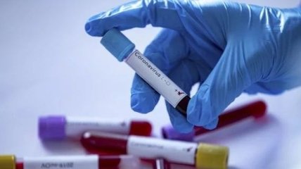 У Львові зареєстровано перший випадок коронавірусу