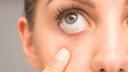 Хвороби ока влітку виникають досить часто