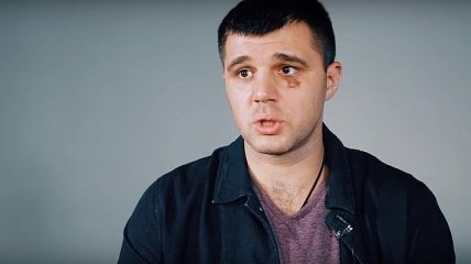 Гвоздик - Стивенсон: боксер Радченко дал прогноз на бой (Видео)