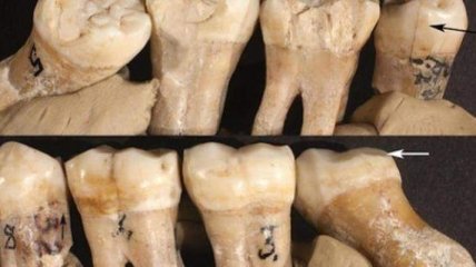 Ученые рассказали, кто придумал стоматологические инструменты