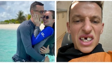 Украинский футболист лишился переднего зуба в матче за день до своей свадьбы (фото)