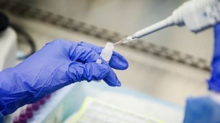Кількість жертв коронавірусу у Франції наблизилася до 25 тисяч