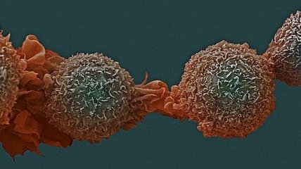 Ученые нашли лекарства, воздействующие на неизлечимую форму рака