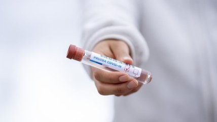 На Буковині за неділю зафіксували 69 нових випадків коронавірусу