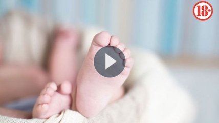 Ребенок «родился в рубашке». Видео новорожденного в амниотическом мешке стало хитом