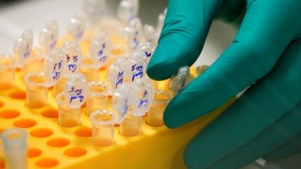 Ученые смогли разработать первую в мире вакцину против вируса Зика 