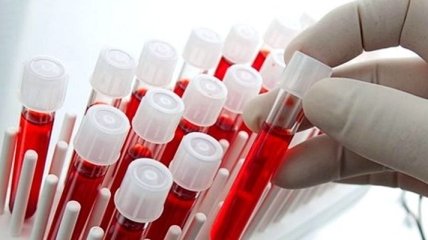 Ученые могут определить вероятность смерти по анализу крови