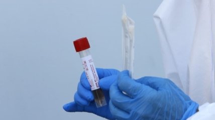 Коронавирус: за сутки в Хмельницкой области выявили еще 10 инфицированных 