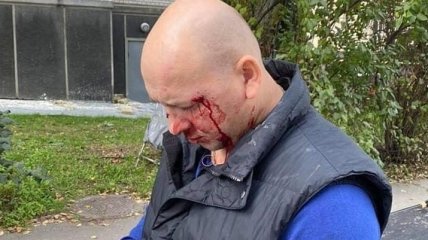 В центре Киева жестоко избили ветерана АТО: его жена раскрыла детали происшествия (видео)