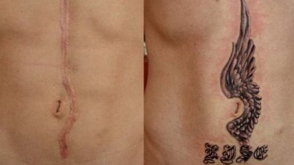 Мода 2018: красивые татуировки, которые помогут скрыть и украсить шрамы (Фото) 