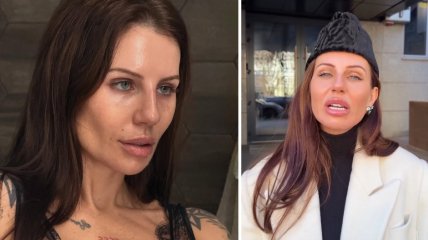 Анна Алхім невдало пожартувала про дубайську війну