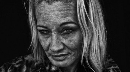 Потерянные Ангелы: лицо наркомании, бездомности и бедности (Фото) 