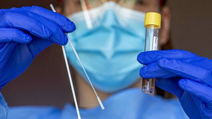 "Стал еще более непредсказуем": медики рассказали о новых симптомах индийского штамма коронавируса