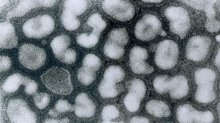 Обнаружено эффективное средство против вируса гриппа